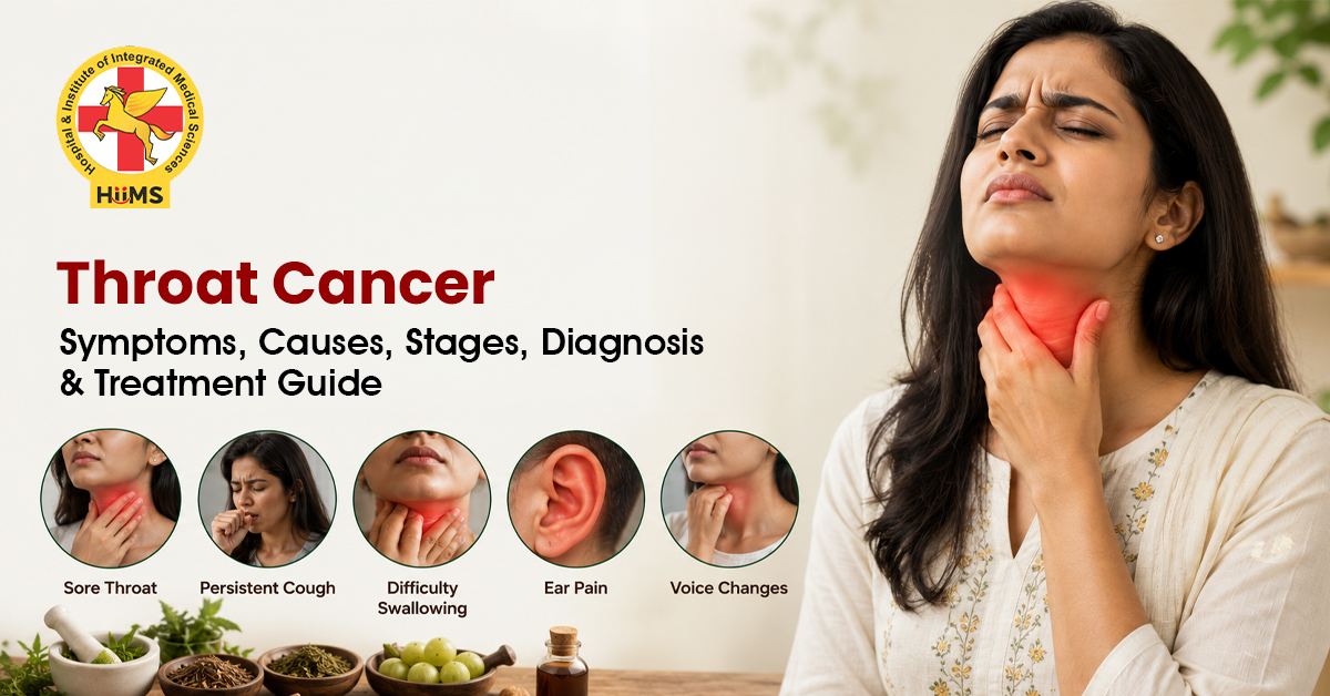 Throat Cancer: A Complete Guide