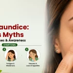 White Jaundice Symptoms and Causes: Separating Facts from Myths