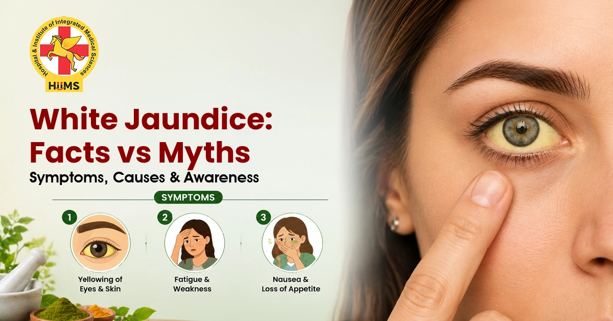 white jaundice treatment