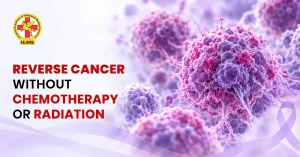 Reverse Cancer Without Chemotherapy or Radiation