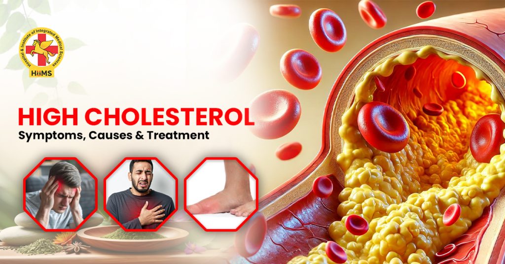 High cholesterol Symptoms, Causes & Treatment