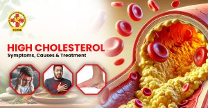 High cholesterol Symptoms, Causes & Treatment