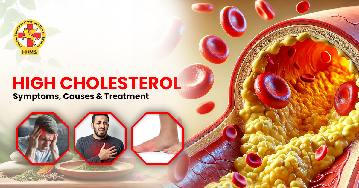 High cholesterol Symptoms, Causes & Treatment