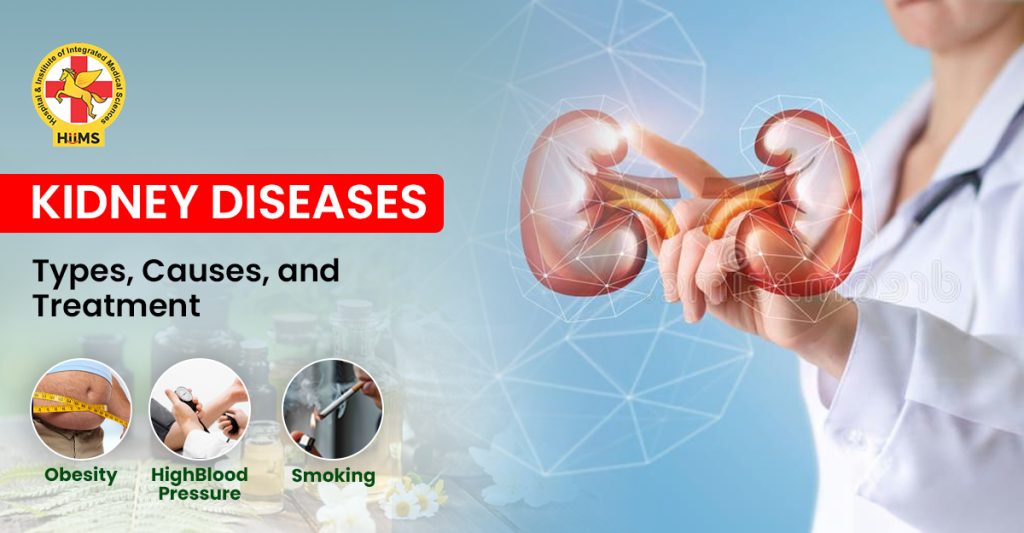 kidney Diseases :Types, Causes, and Treatment