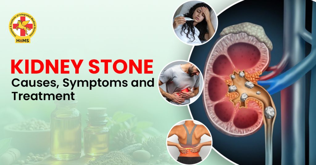 kidney stones treatment