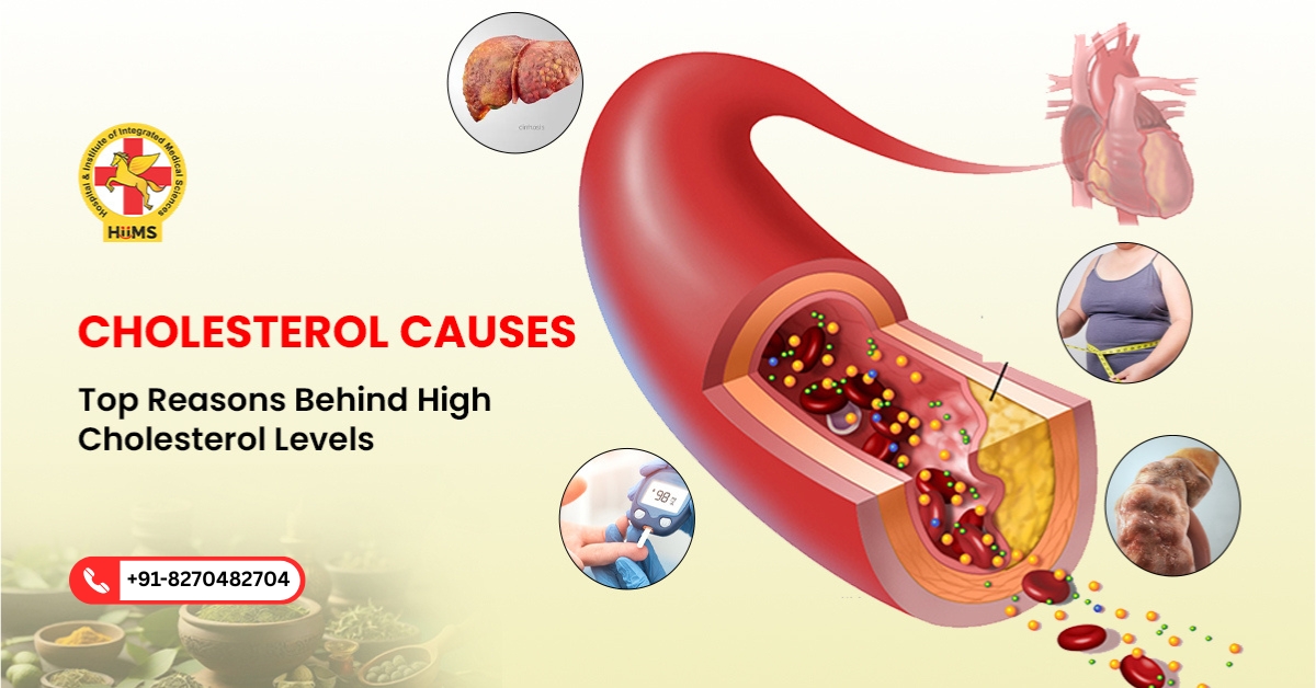 Cholesterol Causes