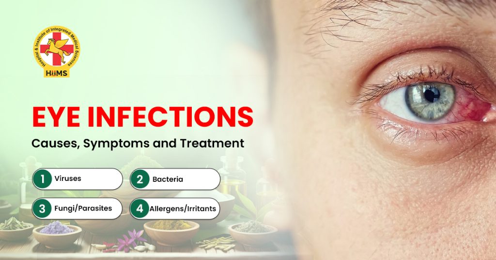 eye Infections treatment