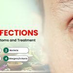 Eye Infections : Causes, Symptoms and Treatment