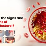 What Are the Signs and Symptoms of High Cholesterol?