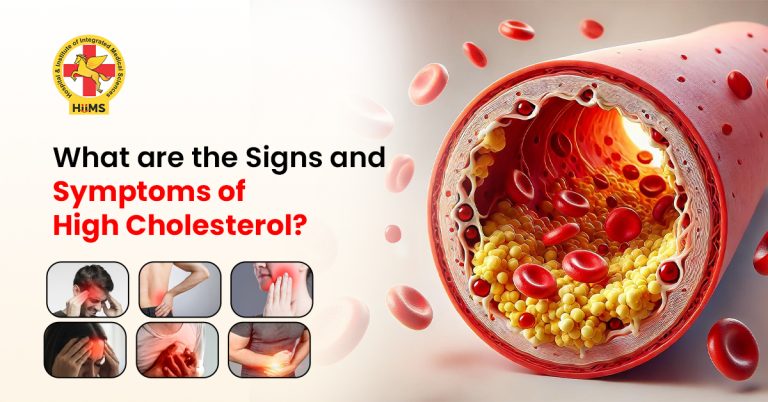 Signs and Symptoms of High Cholesterol