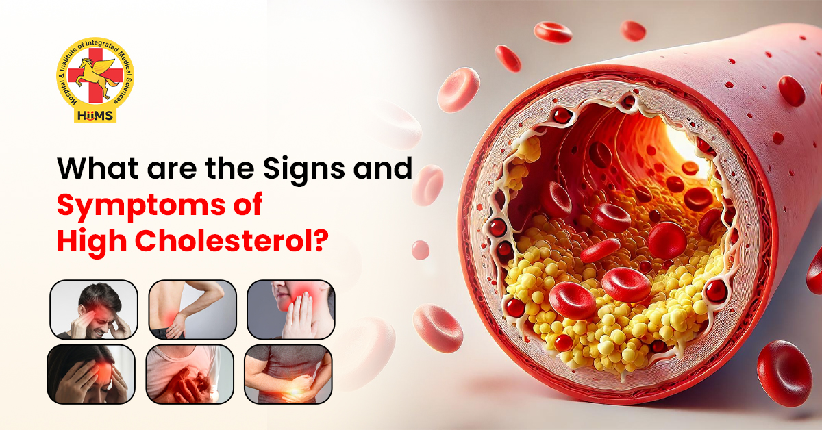Signs and Symptoms of High Cholesterol