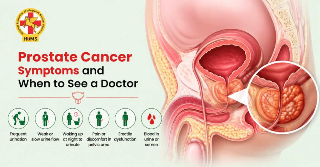 Prostate Cancer Symptoms
