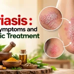 What is Psoriasis : Causes, Symptoms and Ayurvedic Treatment