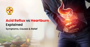 Acid-Reflux-vs-Heartburn