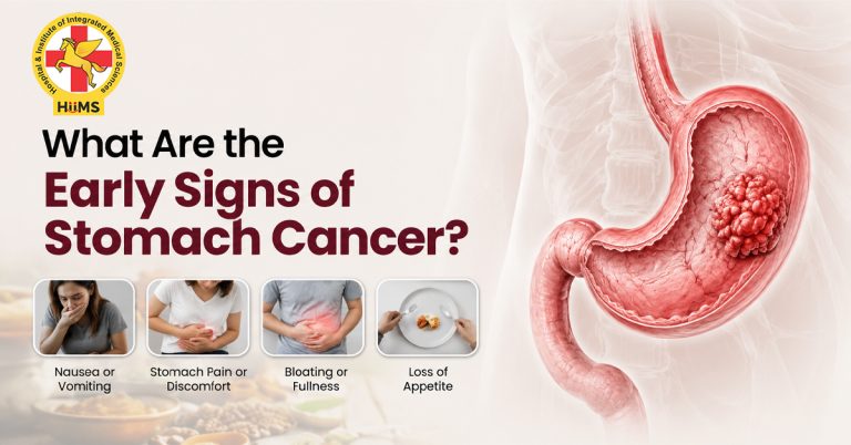 Early Signs of Stomach Cancer