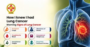 signs-of-lung-cancer