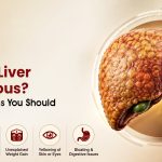 Is Fatty Liver Dangerous? Warning Signs You Should Never Ignore