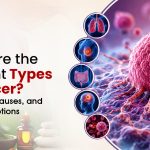 What Are the Different Types of Cancer? Symptoms and Causes