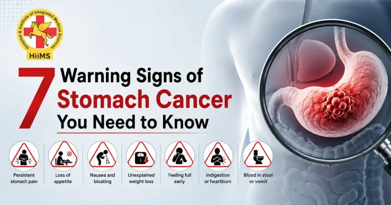 signs of stomach cancer