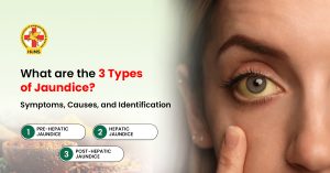Types of Jaundice
