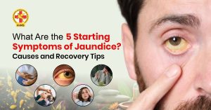 Starting Symptoms of Jaundice