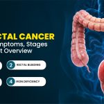 Colorectal Cancer: Causes, Symptoms, Stages & Treatment Overview