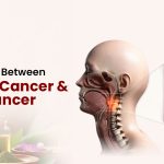 Difference Between Throat Cancer and Oral Cancer