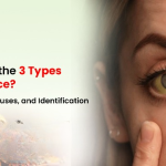 types of jaundice