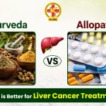 Ayurveda vs Allopathy: Which is Better for Liver Cancer Treatment?
