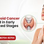 How Thyroid Cancer is Treated in Early & Advanced Stages