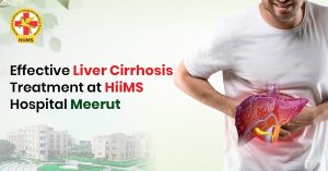 Effective Liver Cirrhosis Treatment at HiiMS Hospital Meerut