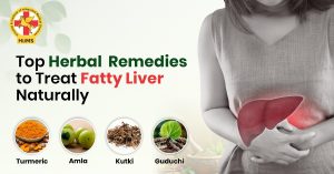 Top Herbal Remedies to Treat Fatty Liver Naturally