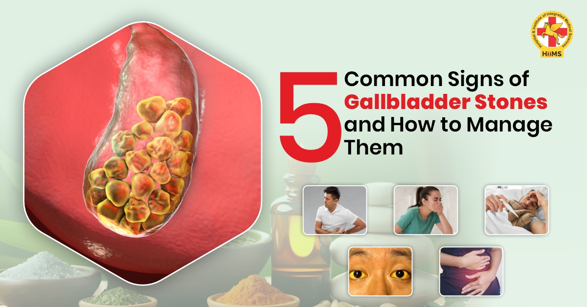 5 Common Signs of Gallbladder Stones and How to Manage Them