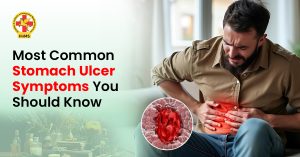Most Common Stomach Ulcer Symptoms You Should Know