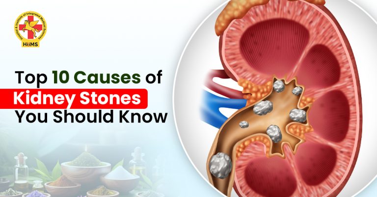 Top 10 Causes of Kidney Stones You Should Know