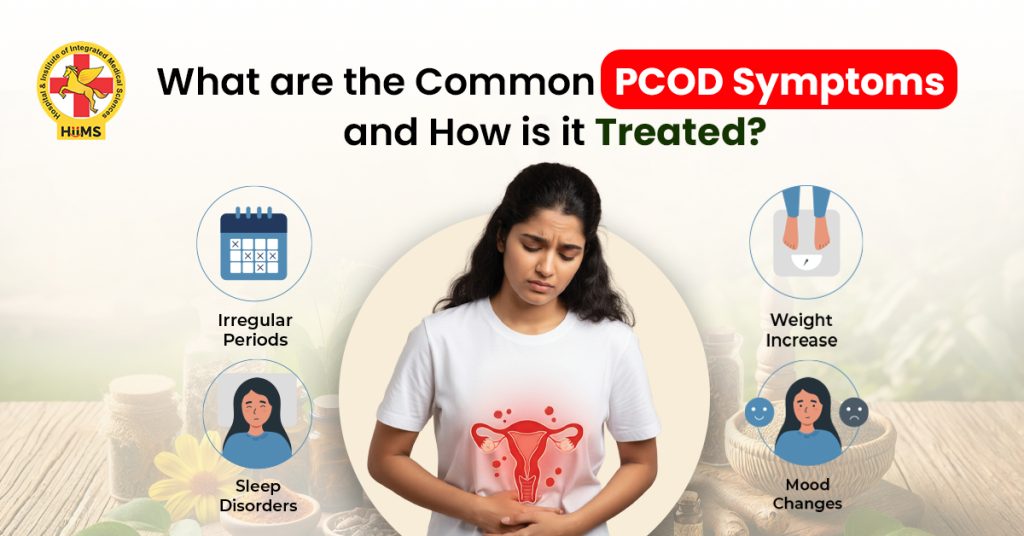 Common PCOD Symptoms and How Is It Treated