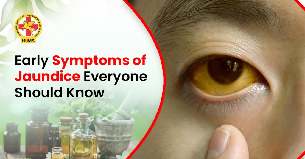 Early Symptoms of Jaundice Everyone Should Know