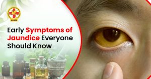 Early Symptoms of Jaundice Everyone Should Know