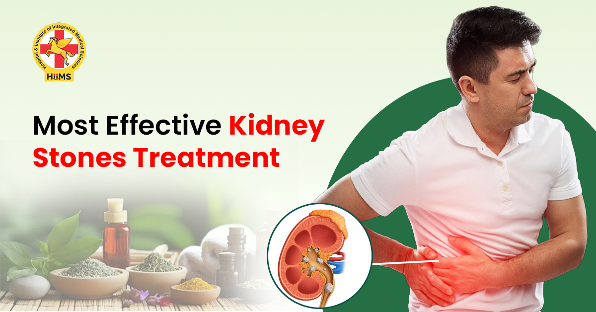 Most Effective Kidney Stones Treatment