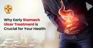 Why Early Stomach Ulcer Treatment is Crucial for Your Health
