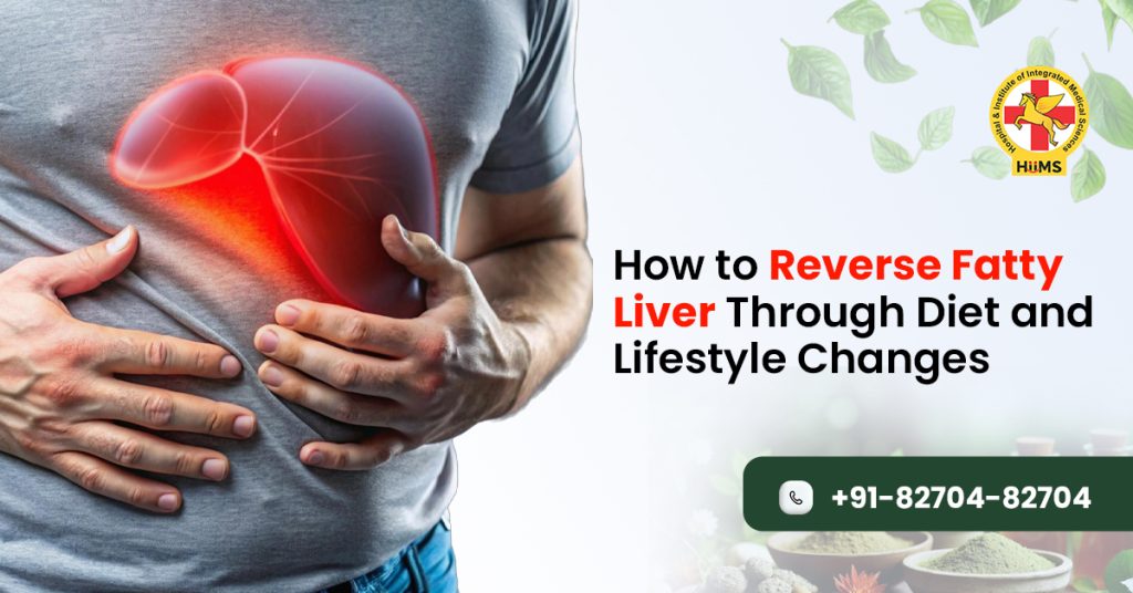 How to Reverse Fatty Liver Through Diet and Lifestyle Changes