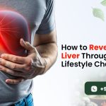 How to Reverse Fatty Liver Through Diet and Lifestyle Changes