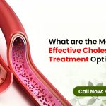 What Are the Most Effective Cholesterol Treatment Options Today