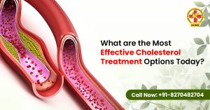 What Are the Most Effective Cholesterol Treatment Options Today