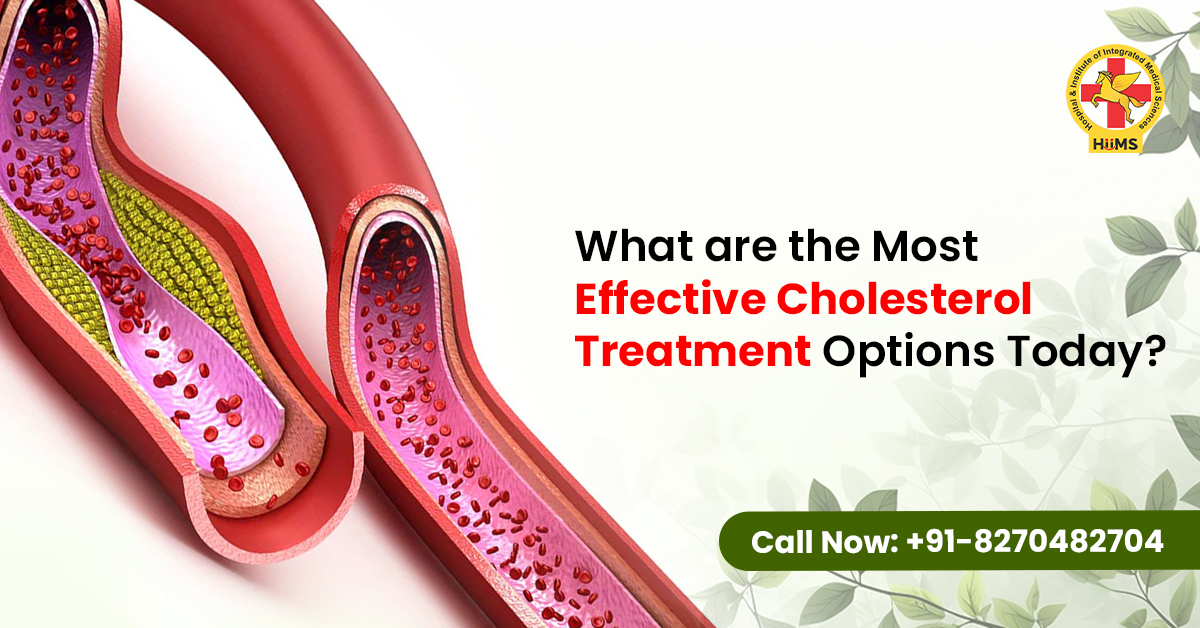 What Are the Most Effective Cholesterol Treatment Options Today
