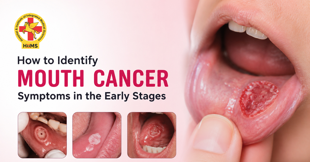 How-to-Identify-Mouth-Cancer-Symptoms-in-the-Early-Stages