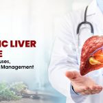 Chronic Liver Disease: Symptoms, Causes, Diagnosis, and Management