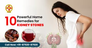 Home remedies for kidney stones removal
