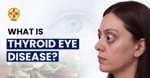 what is thyroid eye disease