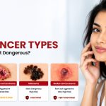 Skin Cancer Types: Which One Is Most Dangerous?